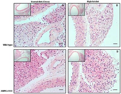 High Fat Diet Attenuates the Anticontractile Activity of Aortic PVAT via a Mechanism Involving AMPK and Reduced Adiponectin Secretion